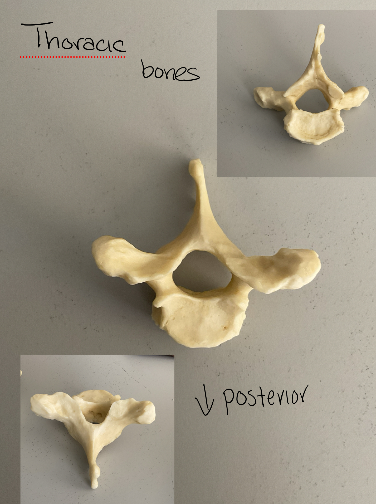 <p>Thoracic </p>