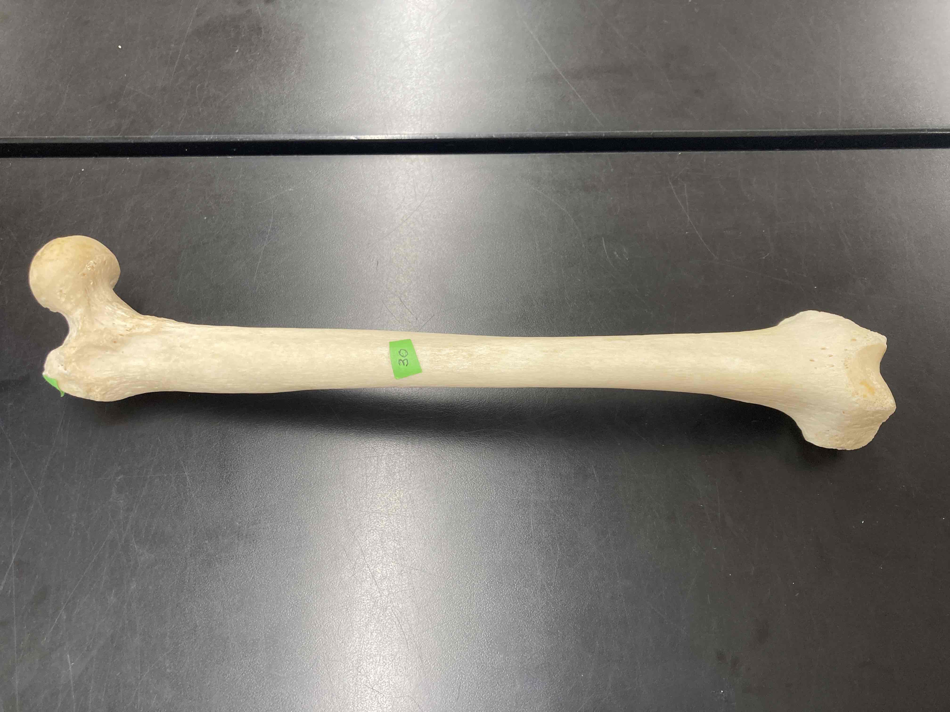 <p>What is the name of this bone?</p>