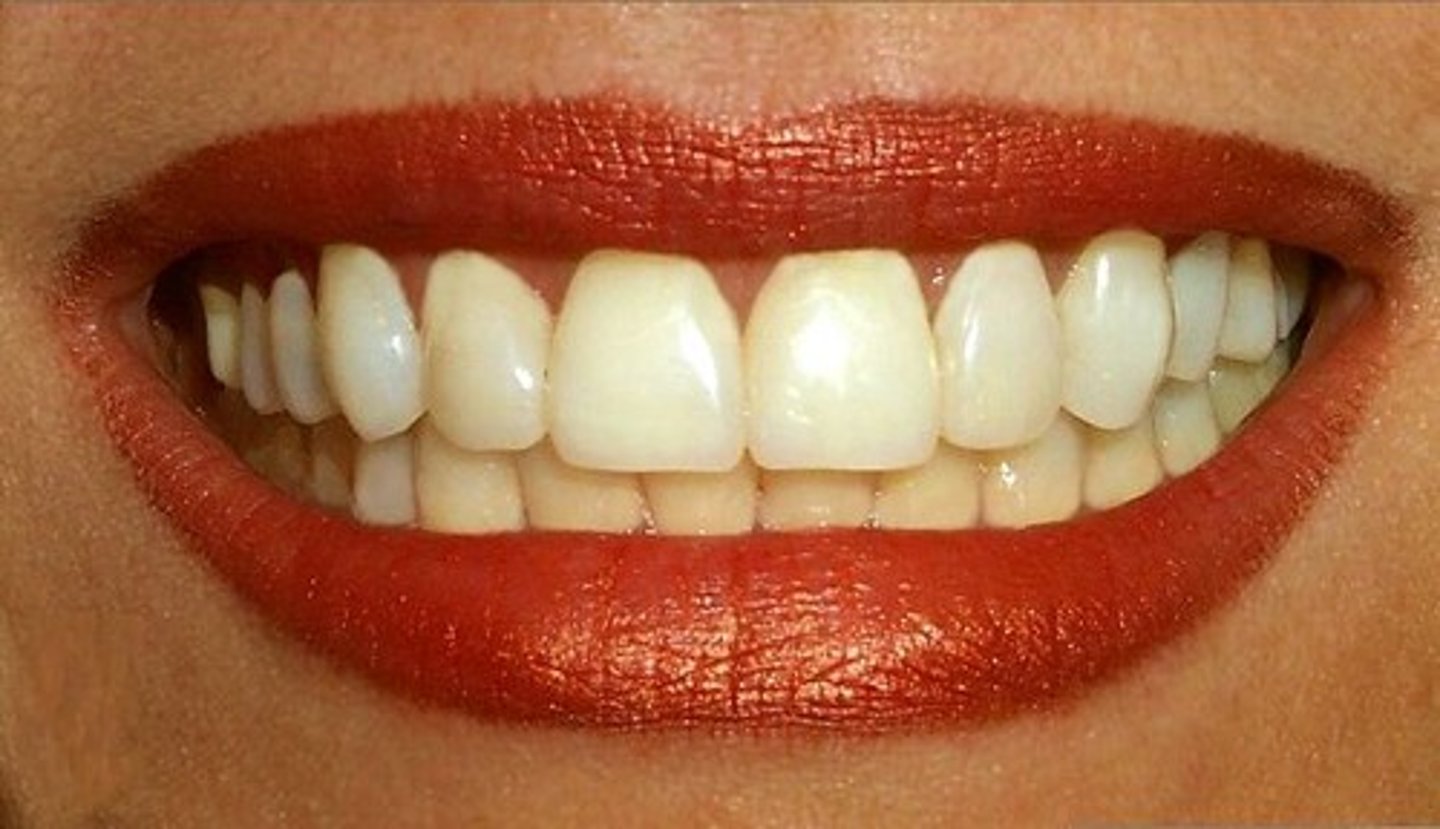 <p>teeth</p>