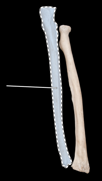 <p>Name this bone.</p><p>(Posterior view).</p>
