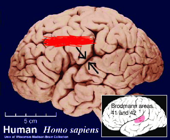 <p>Separates the temporal lobe from the frontal and parietal lobes</p>