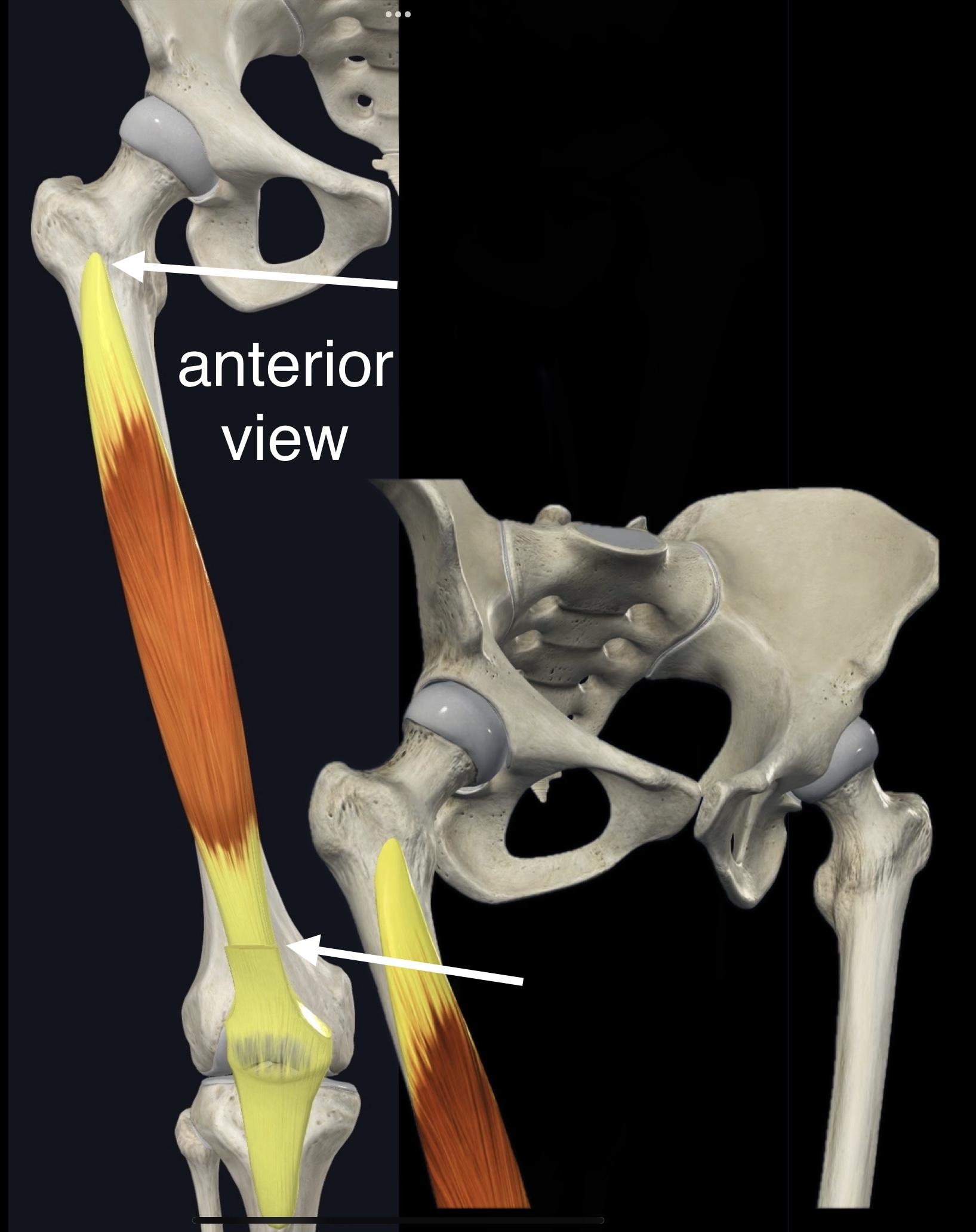 <p>Name the muscle, origin and insertion</p>
