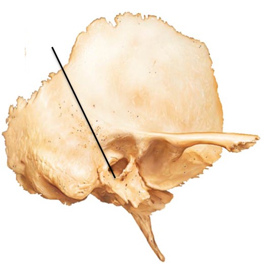 <p>what bone structure is the arrow pointing to?</p>