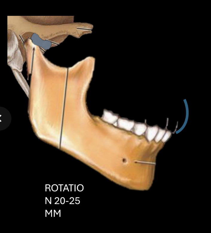 <p>Rotation 20-25 mm (mouth opening starts with rotation of condyle under disc)</p>