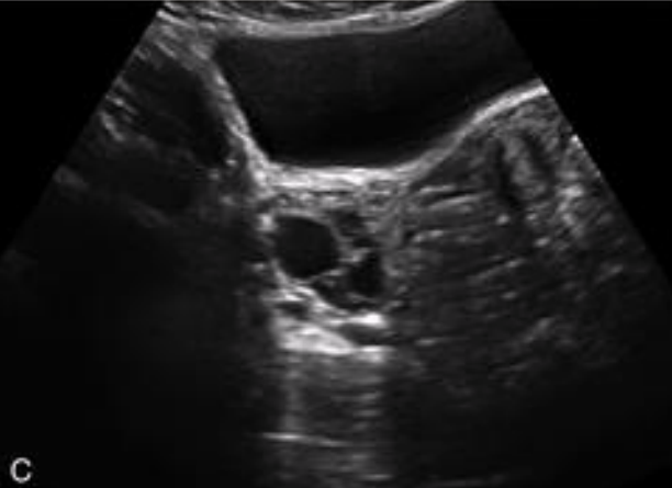 <p>What is shown in this image?</p>