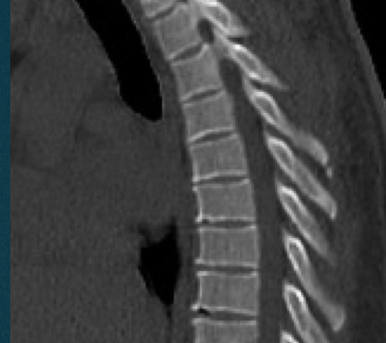 <p>What anomaly is this?</p>