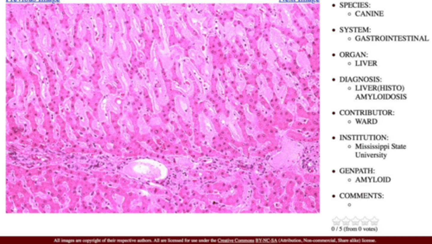 <p>Amyloid light chain protein (AL) and amyloid associated protein (AA).</p>