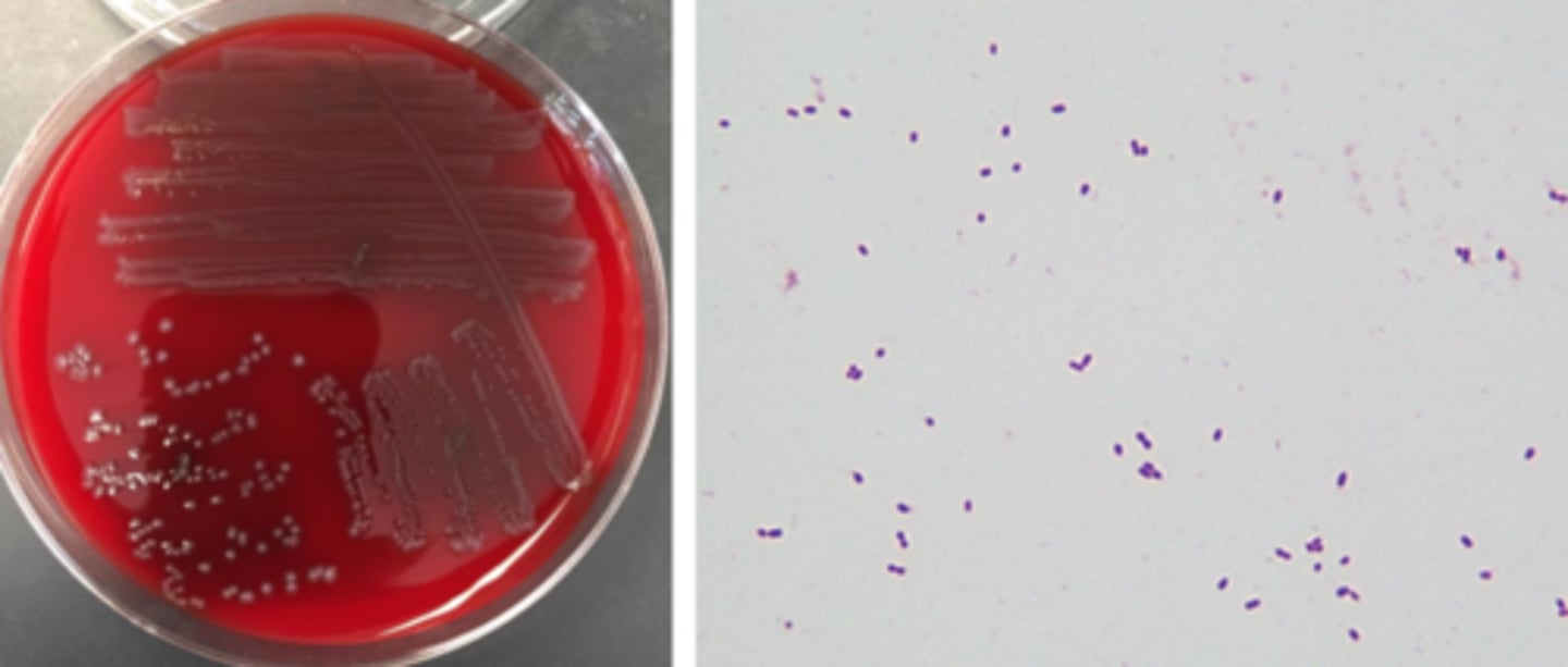 <p>non-hemolytic</p><p>VRE often alpha-hemolytic</p><p>grey pigment</p><p>smallish colony</p><p>cocci in pairs</p>