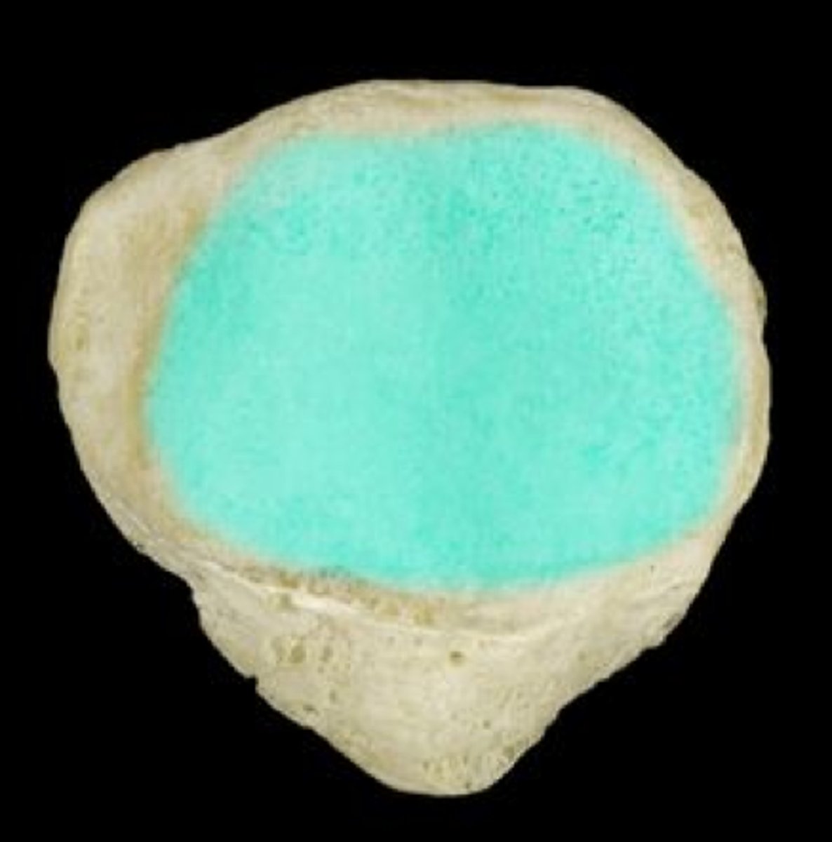 <p>Name the structure.</p>