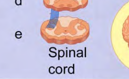<p>In Figure 13.14e, why has the artist colored the central portion of the spinal cord darker than the surrounding portion?</p>