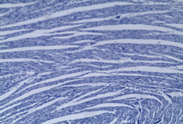 <p>What type of muscle tissue is this</p>
