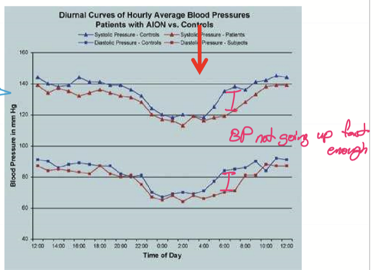 <ul><li><p>Nocturnal hypotension with poor autoregulation</p></li><li><p>High cholesterol</p></li><li><p>Sleep apnea</p></li><li><p>Rx: </p><ul><li><p>Antihypertensive Rx</p></li><li><p>Erectile dysfunction Rx (within 24 hours)</p></li><li><p>GLP-1? </p></li></ul></li></ul><p></p>