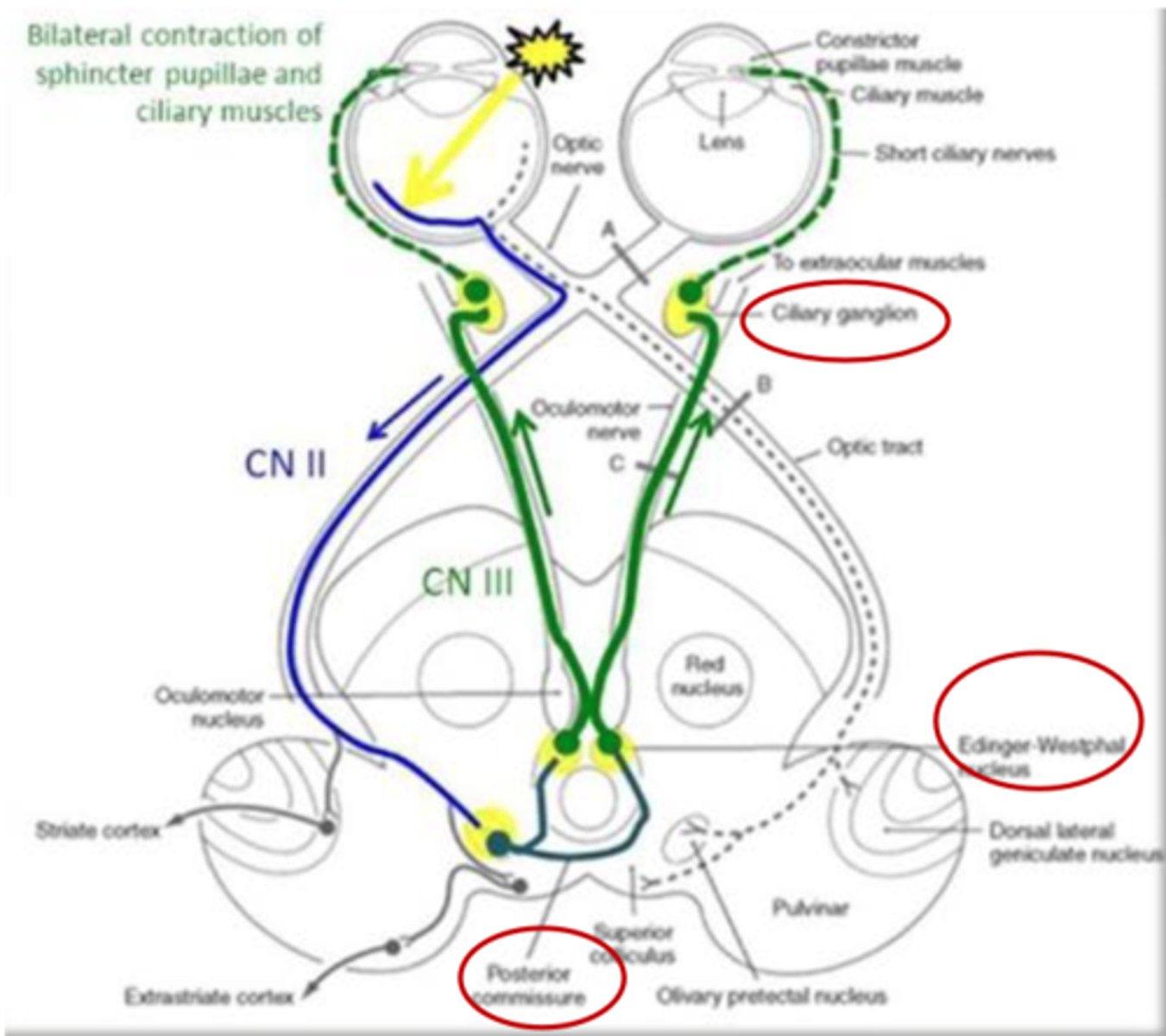 <p>- Pupillary light reflex dysfunction</p><p>- No detection of visual stimulation</p>