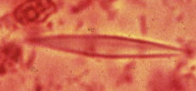 <p>What are these? How are they formed? What do they indicate?</p>