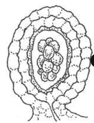 <p>Eusporangiate sporangium </p>