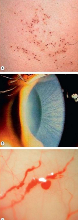 <p>What condition is this?</p>