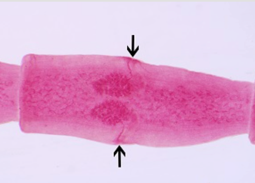 Proglottid of _____________. The _____ are clearly visible in the ________-stained proglottid.
