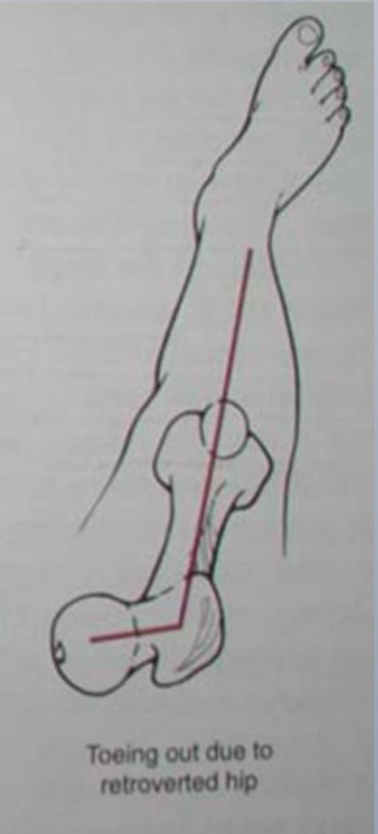 <p>turning backward</p>