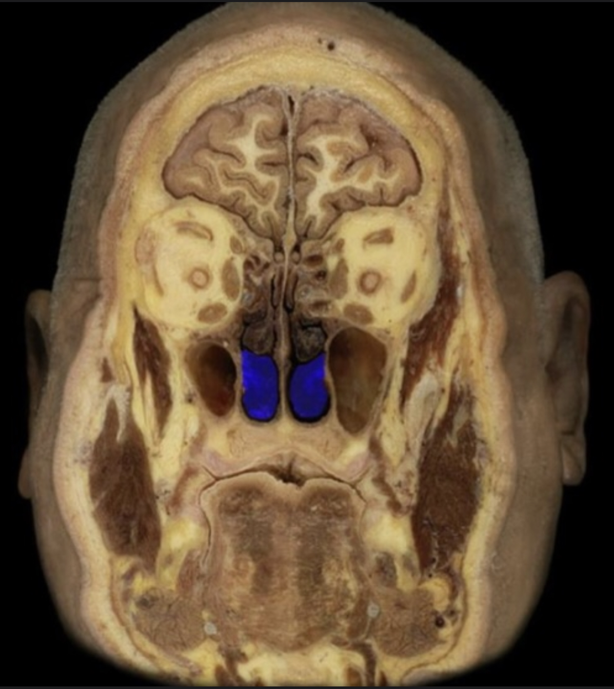 What structure is highlighted in blue?