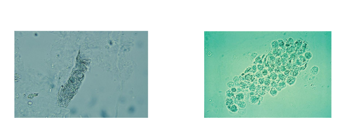 <p><span style="font-family: Arial, sans-serif">WBC Casts</span></p>