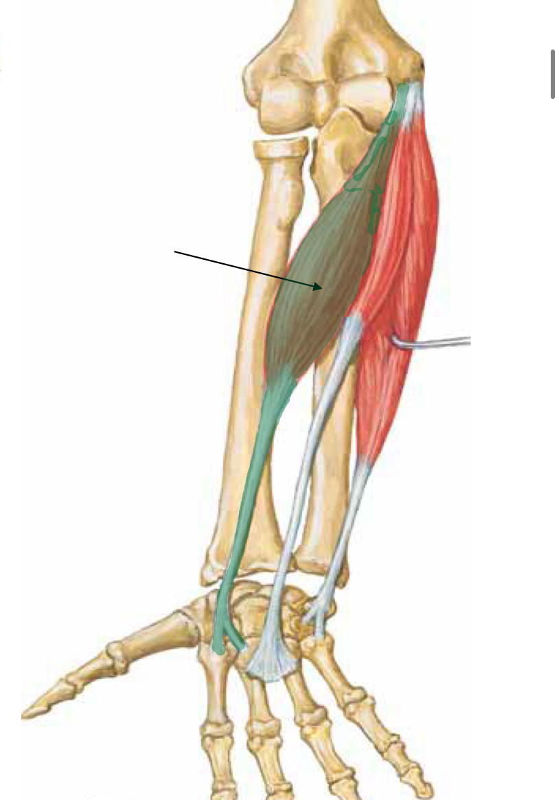 <p>What muscle is indicated?</p>