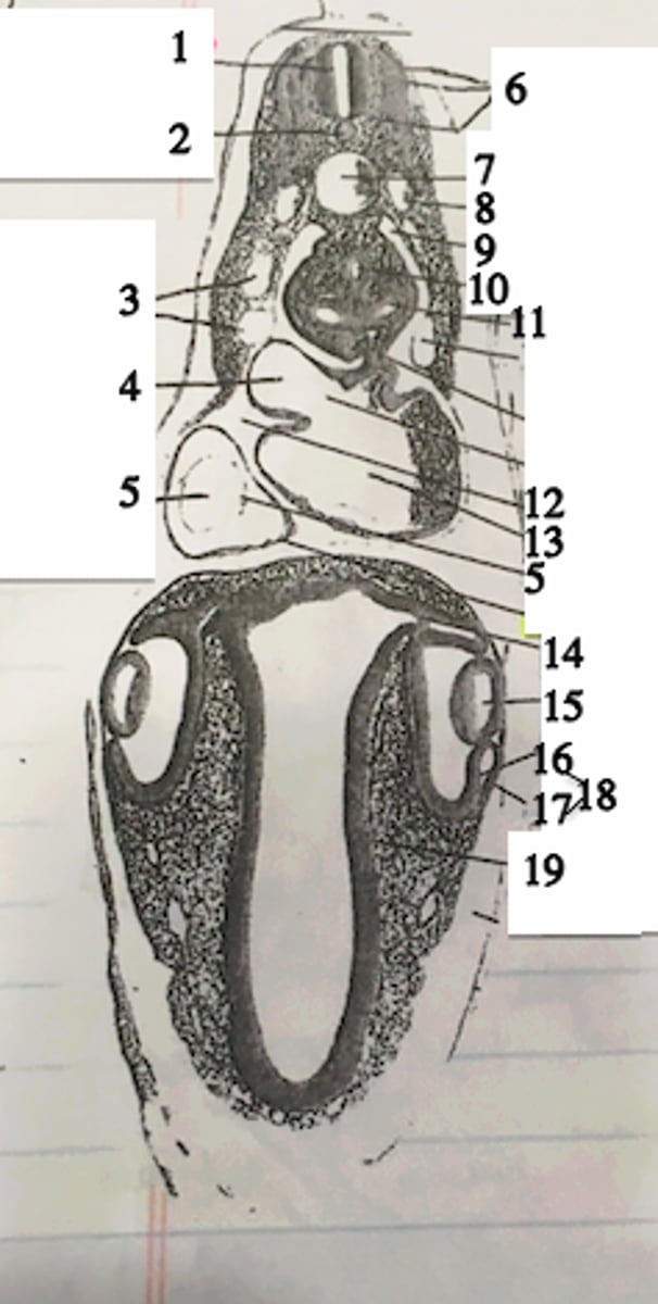 <p>#16</p>