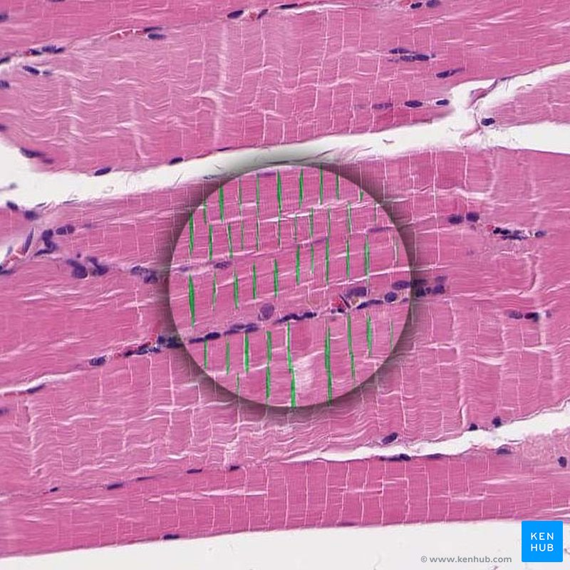 <p>muscle that’s long, cylindrical multinucleate cells; obvious striations</p>