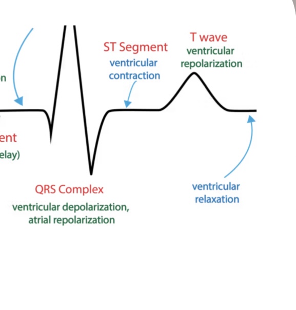 <p>Action potential causes <strong>Ventricle to depolarize</strong></p><ul><li><p><span style="color: rgb(23, 2, 255)">Electrical: NONE</span></p></li><li><p><span style="color: rgb(23, 2, 255)">Ven<strong><em>Tricle conTraction= → S-T segment</em></strong></span></p></li><li><p><span style="color: rgb(242, 72, 255)">Mechanical</span> event: <span style="color: rgb(255, 70, 251)">ventricular <strong>CONTRACTION</strong></span></p></li></ul><p></p>