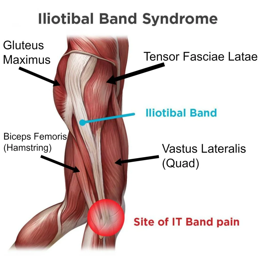 <ul><li><p>Action: Laterally supports the knee when the tensor fasciae lata contracts</p></li><li><p>Innervation: N/A</p></li><li><p>Origin: Iliac crest</p></li><li><p>Insertion: Lateral condyle of tibia</p></li></ul><p></p>