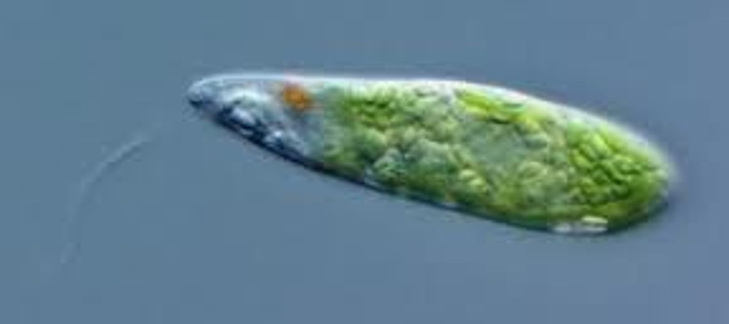 <p>Protists; single-celled or multicellular organisms such as amoeba, euglena, paramecium, algae and slime molds</p>