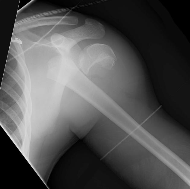 <p>Describe the abnormality demonstrated.</p>