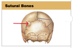 What are sutural bones?