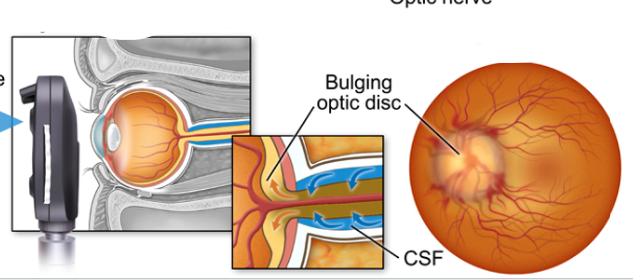 <p>what diagnosis</p>