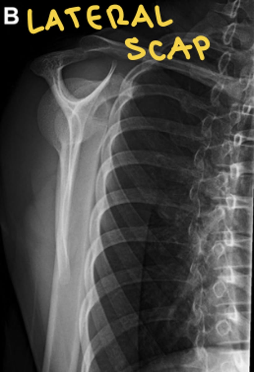 <p>space between scapula and ribs</p>