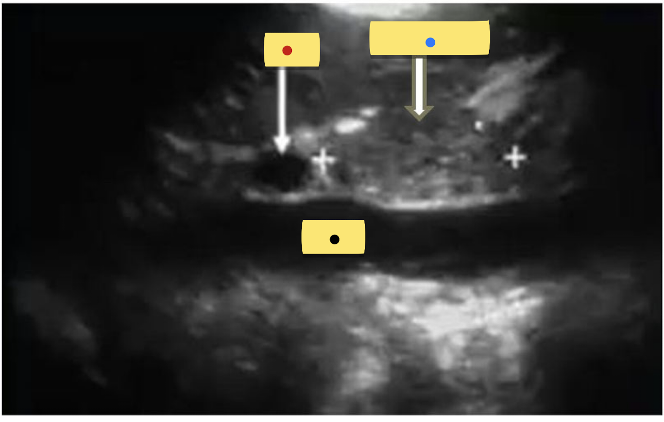 <p>identify the sagittal image. </p><p>Red = ?</p><p>Blue = ?</p><p>Black = ?</p>