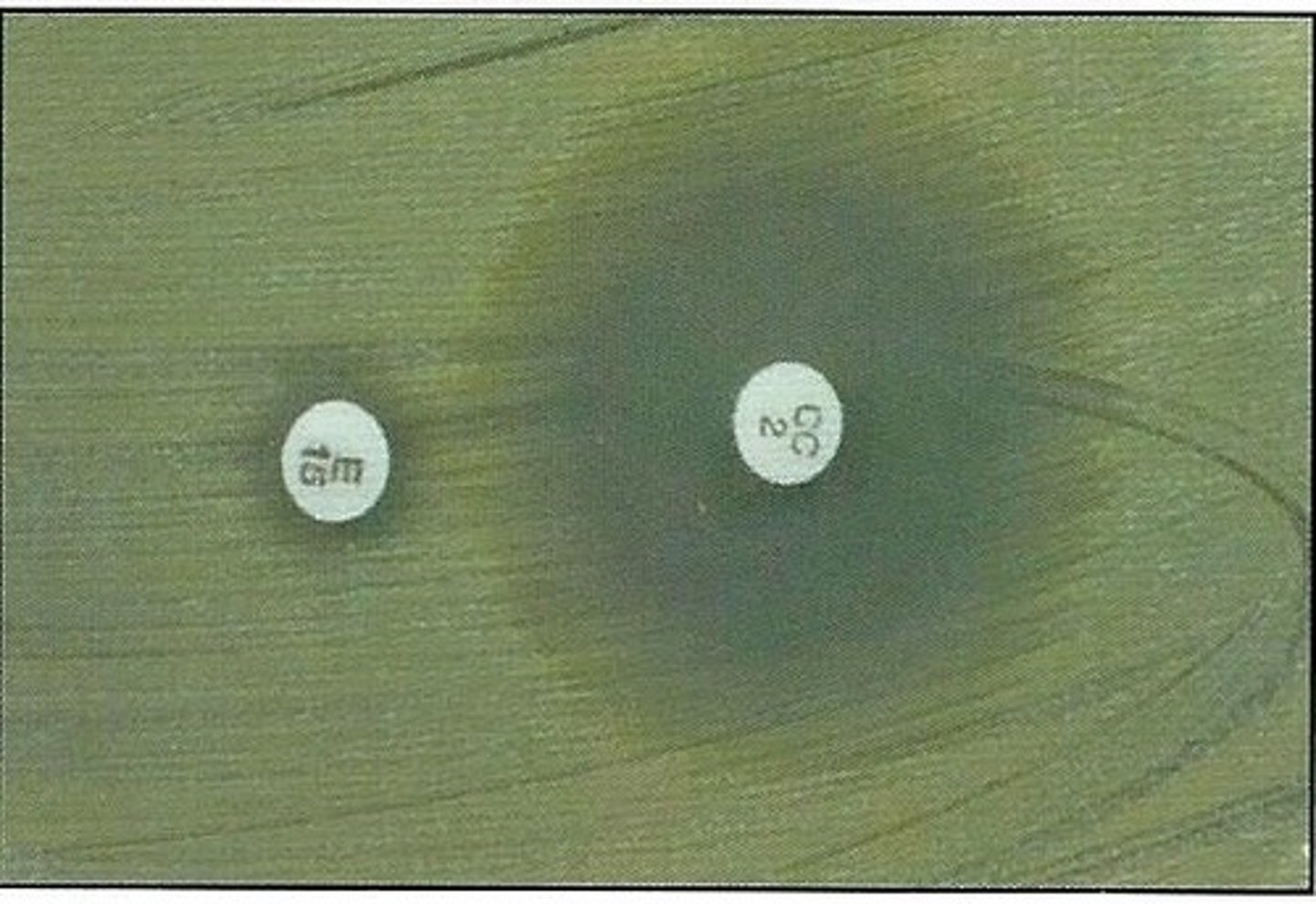 <p>What is the ring called?</p>