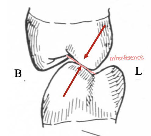 <p>Type of contact</p>