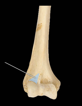 <p>humerus</p>