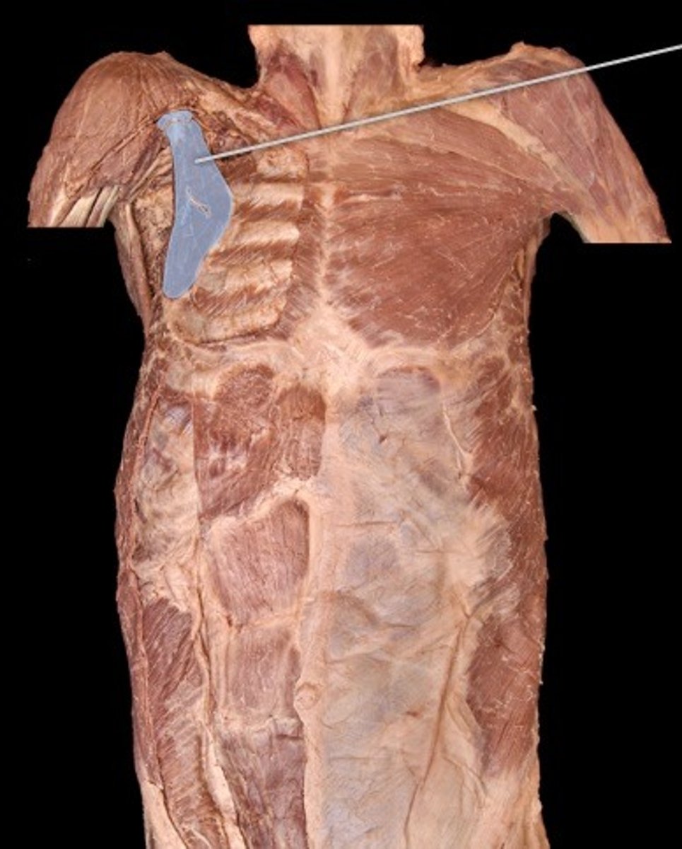 <p>What muscle is this?</p>