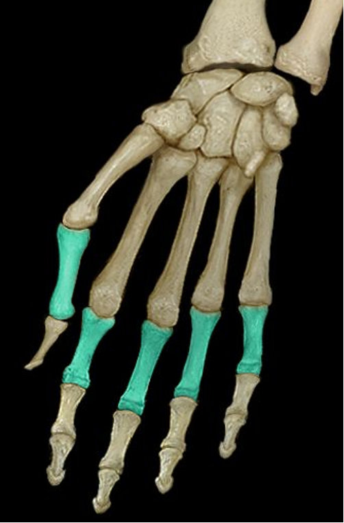 <p>Articulates with the head of the metacarpal</p>