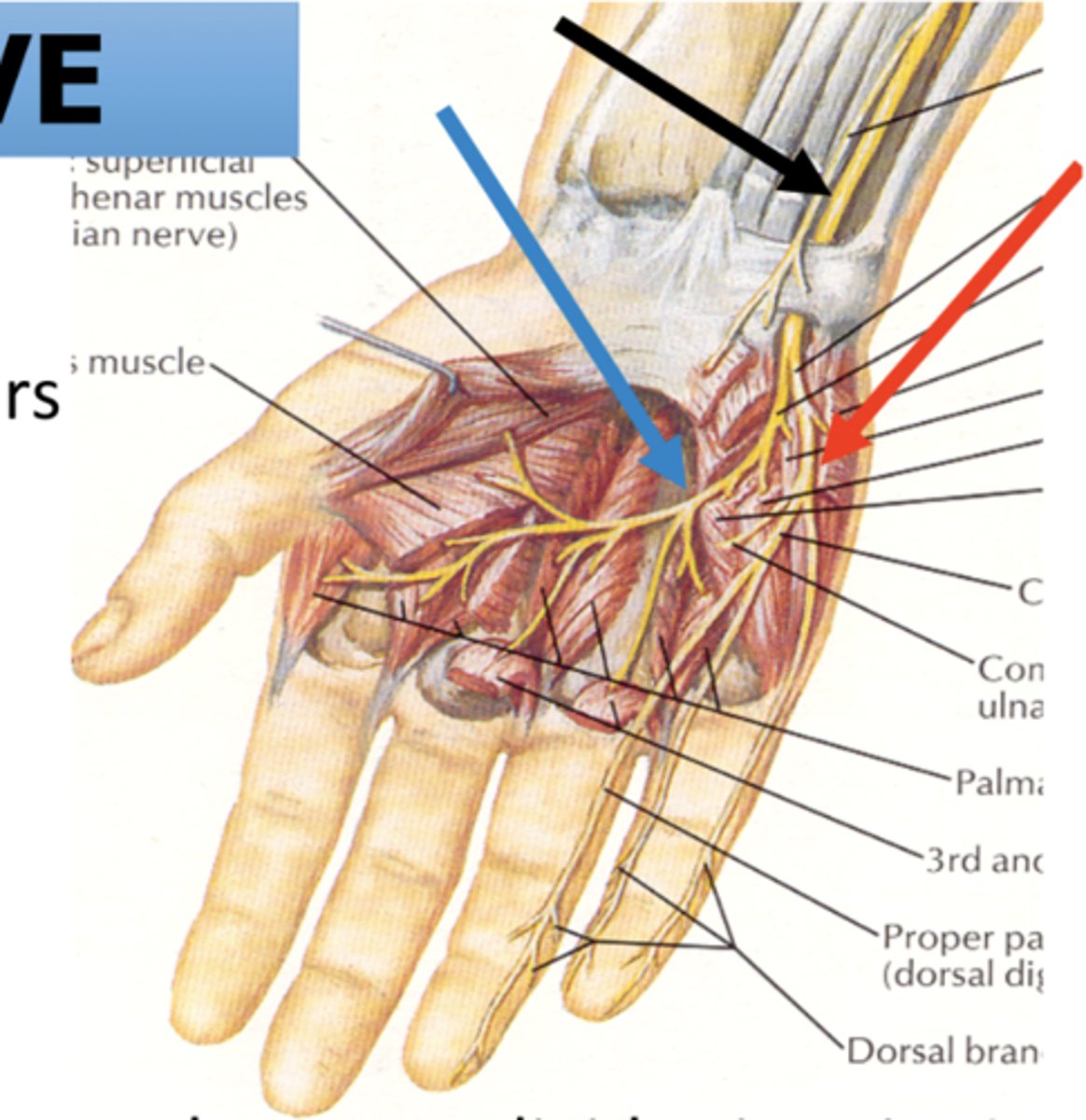 <p>lateral </p><p>TWO terminal branches </p><p>1. Superficial branch of ulnar nerve (red arrow) </p><p>2. deep branch of ulnar nerve (blue arrow) </p>