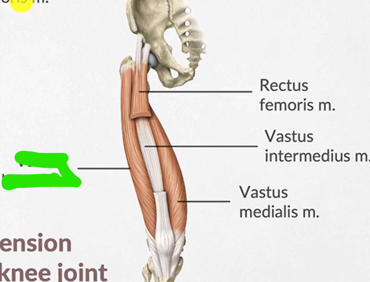 term image