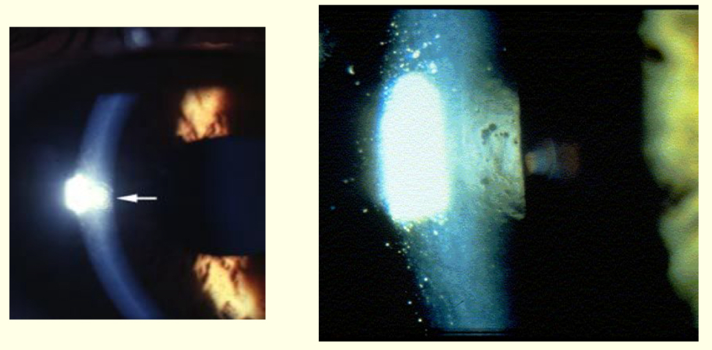 <p>Whst method and what structures is being observed?</p>