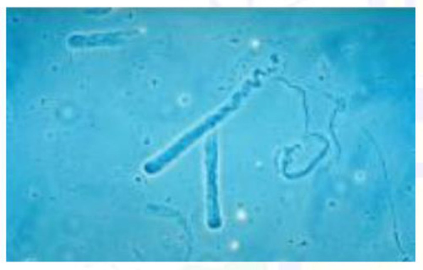 <p>structures w/ tapered ends that are formed at the junction ascending loop of Henle and the distal convoluted tubule</p>