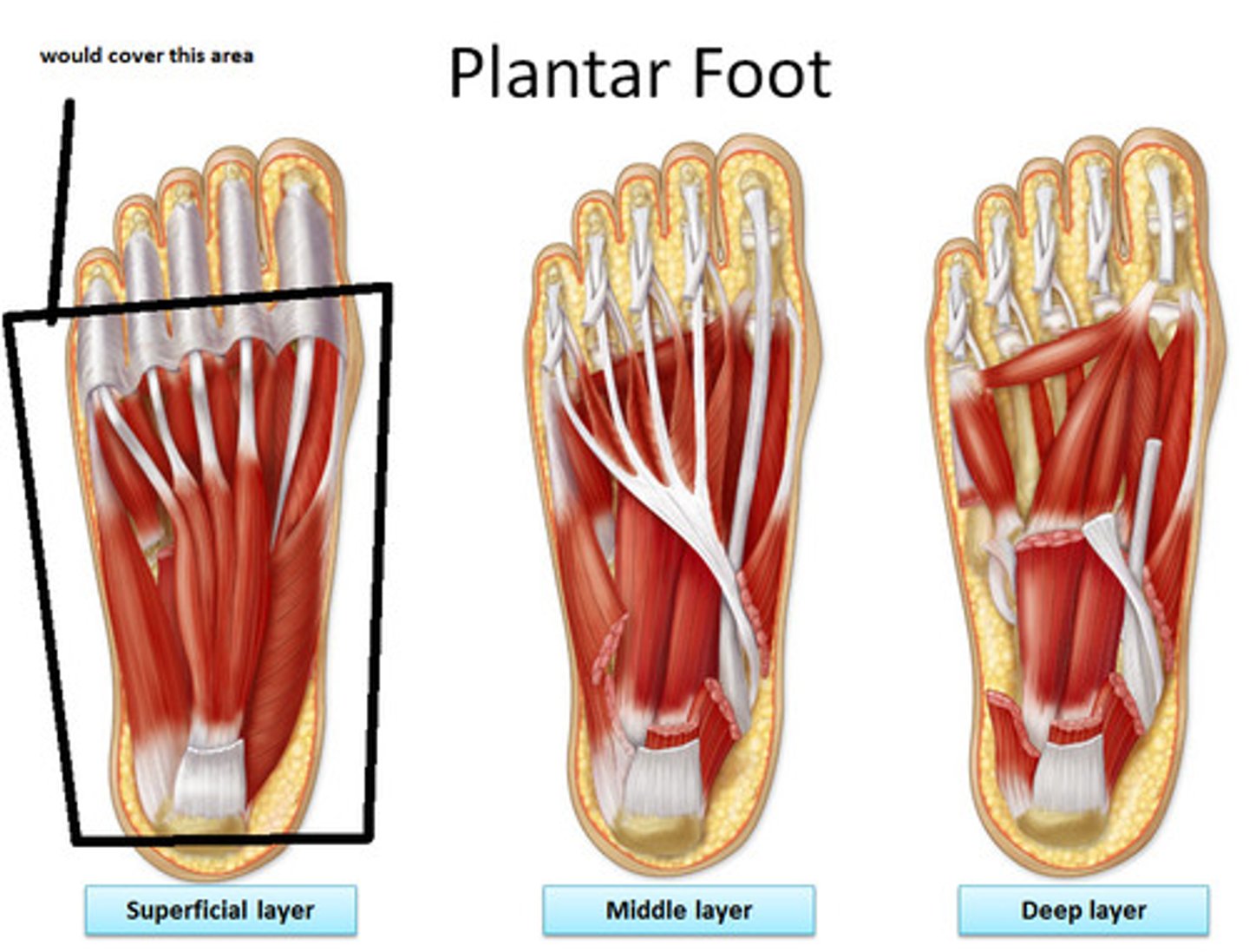 <p>broad CT sheet coverin plantar surface of foot</p>