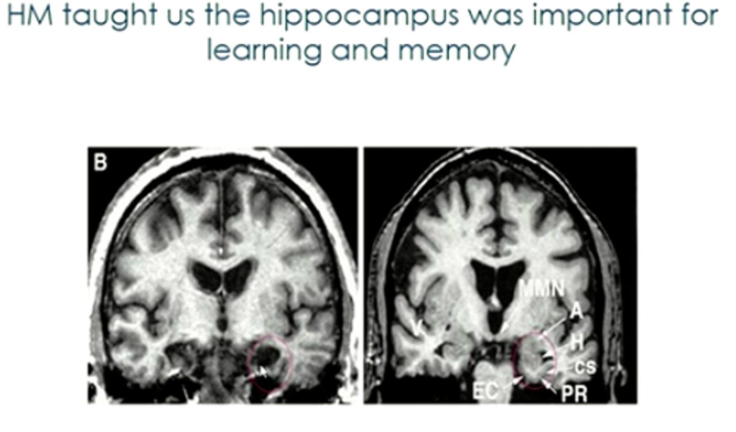<p>It provides a more complete and in depth account of the individual. This may complement the nomothetic approach by gathering more info on general laws or challenging such laws. For example HM (memory case study) indicated that LTM was not a unitary store and procedural memory was one such separate store. This can be used to generate hypotheses that can later be tested experimentally.</p>