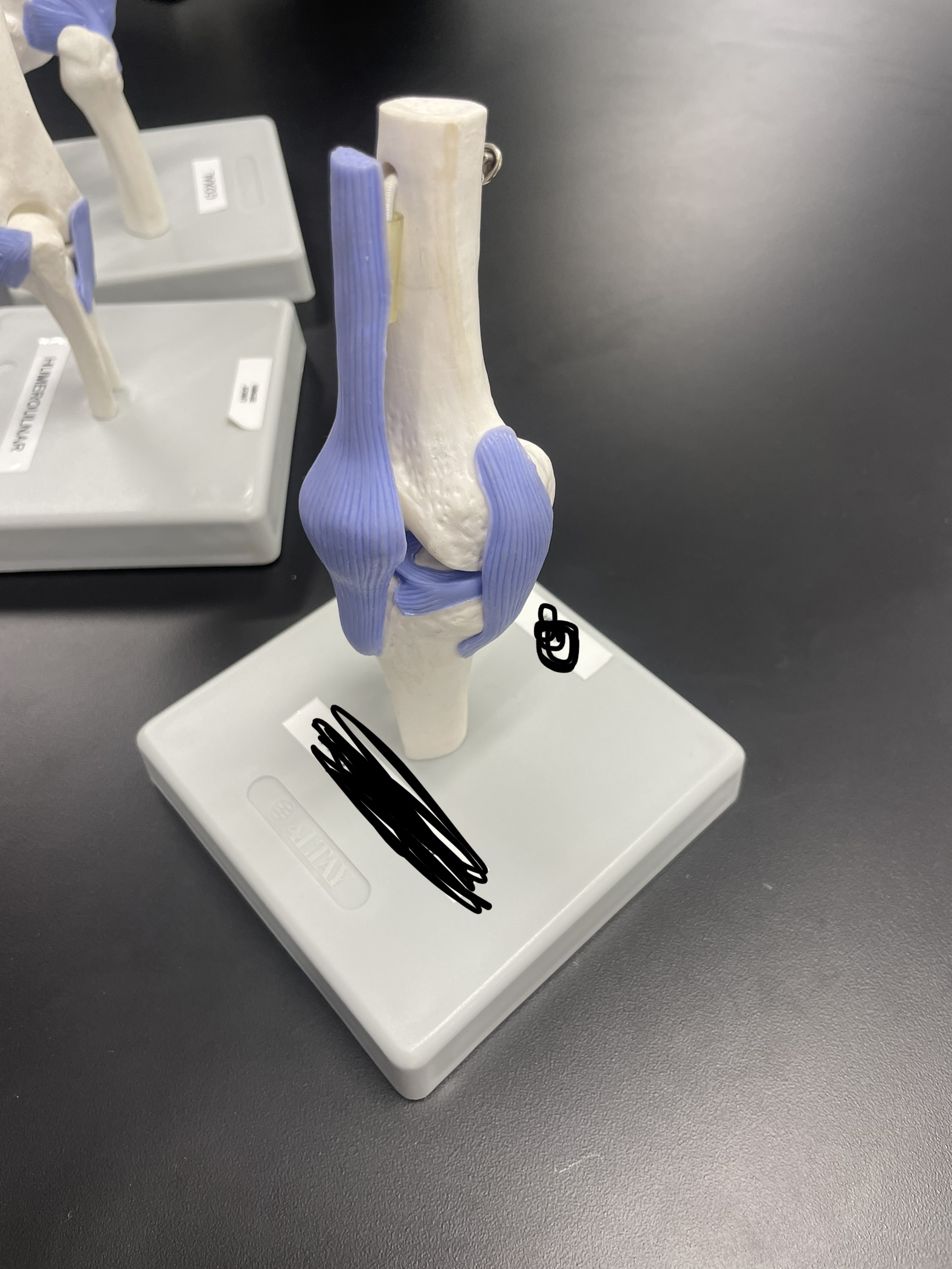 What type of joint is this