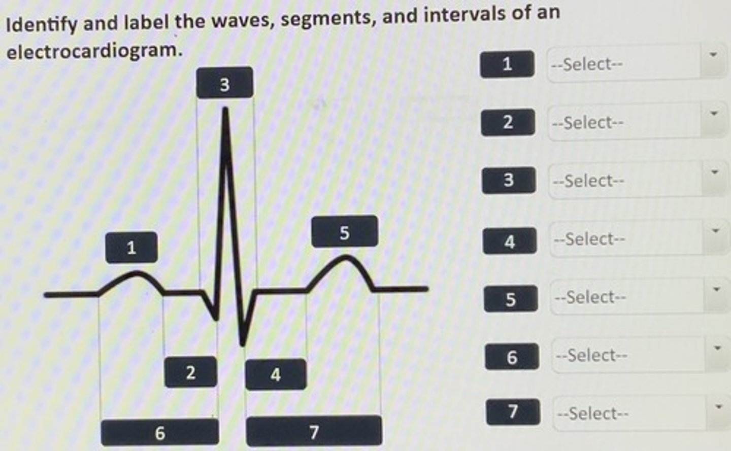 <p>1. P wave</p><p>2. P-R segment</p><p>3. QRS complex</p><p>4. S-T segment</p><p>5. T wave</p><p>6. P-R interval</p><p>7. S-T interval</p>