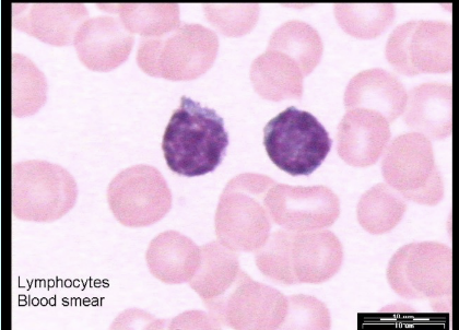 <ol start="2"><li><p>Lymphocytes - make antibodies, attack virus-infected cells and cancer cells</p></li></ol>