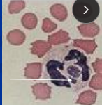 <p><span>Equine Granulocytic Anaplasmosis</span></p>